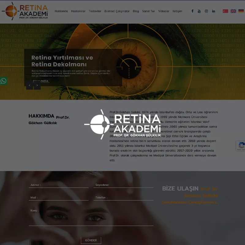 retina