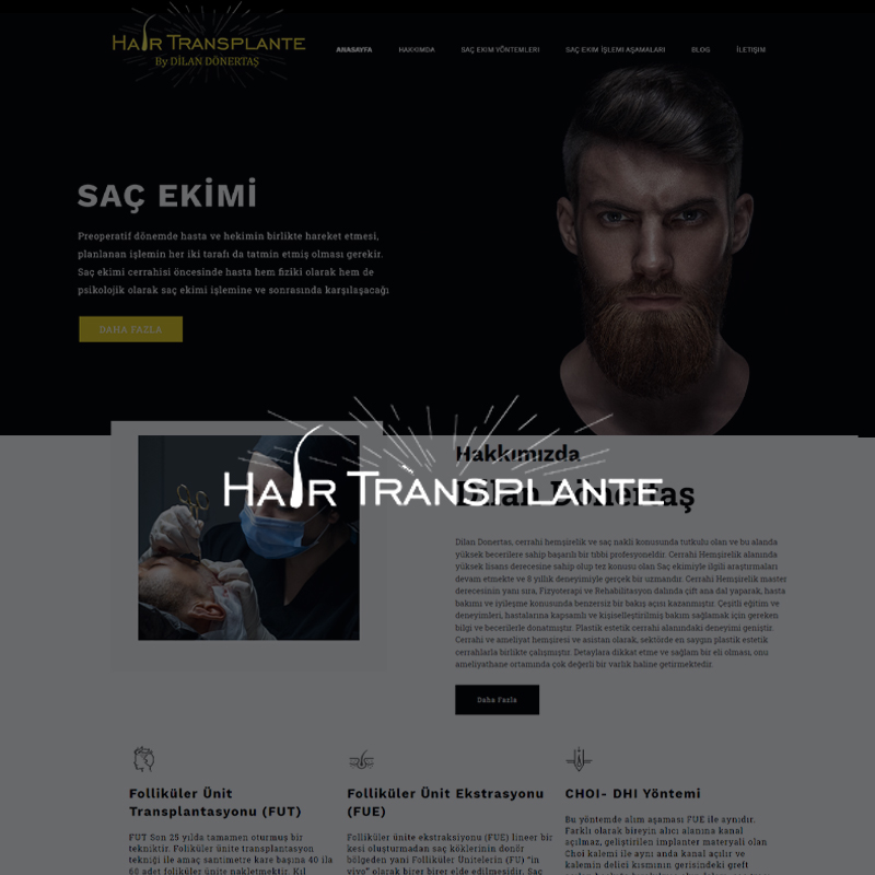 hair-transplante