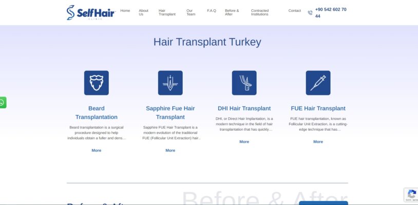 selfhairclinic-image-2