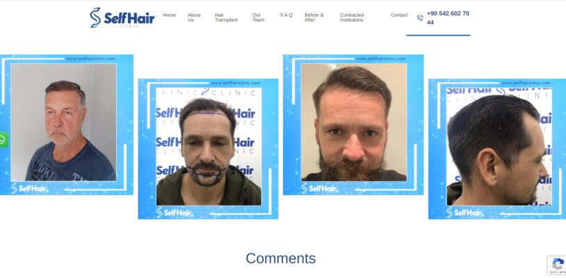 selfhairclinic-image-1