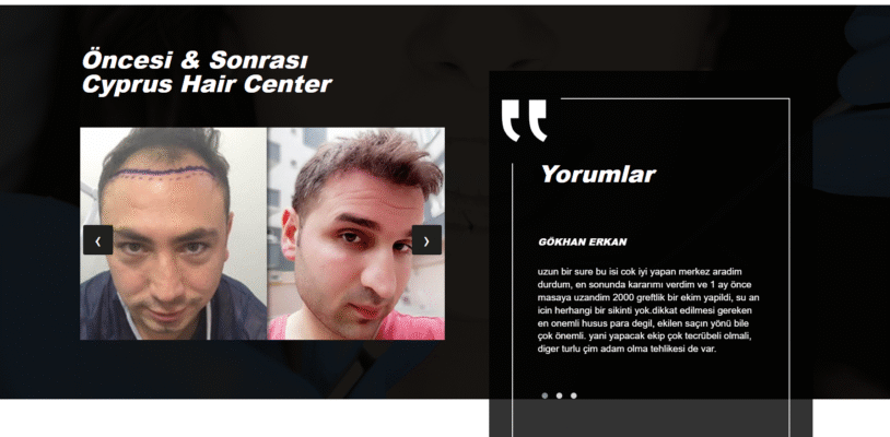 cyprushaircenter-image-3