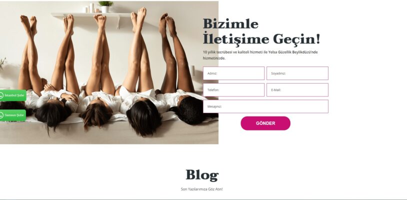 Yelsa Estetik Guzellik-image-3