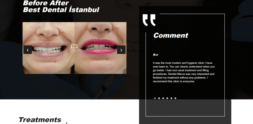 bestdentalistanbul-image-3